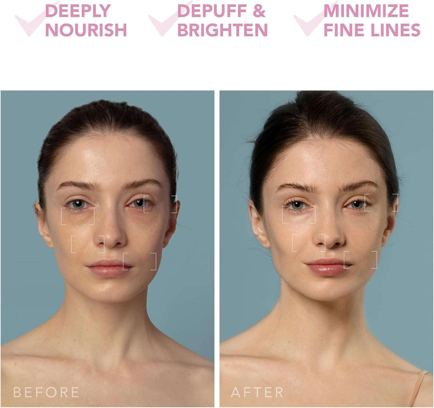 2026 2025 FOREO UFO 3 – Masque Visage Intelligent 5-en-1 avec LED, Thermothérapie, Cryothérapie et Massage T-Sonic – Édition Limitée Anti-Âge